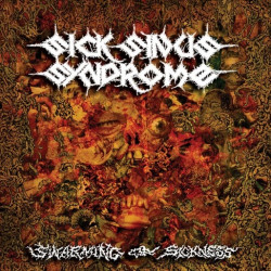 SICK SINUS SYNDROM_cd